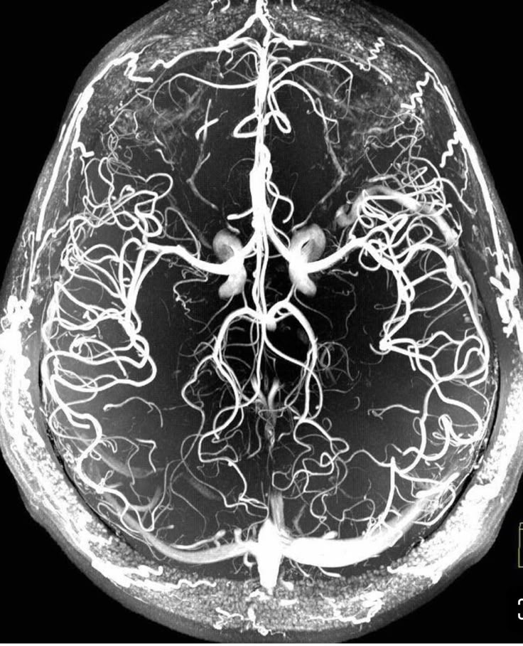 Post by @infomedicos · 1 image
